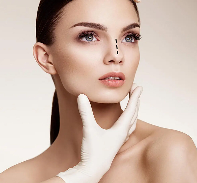 Rhinoplasty