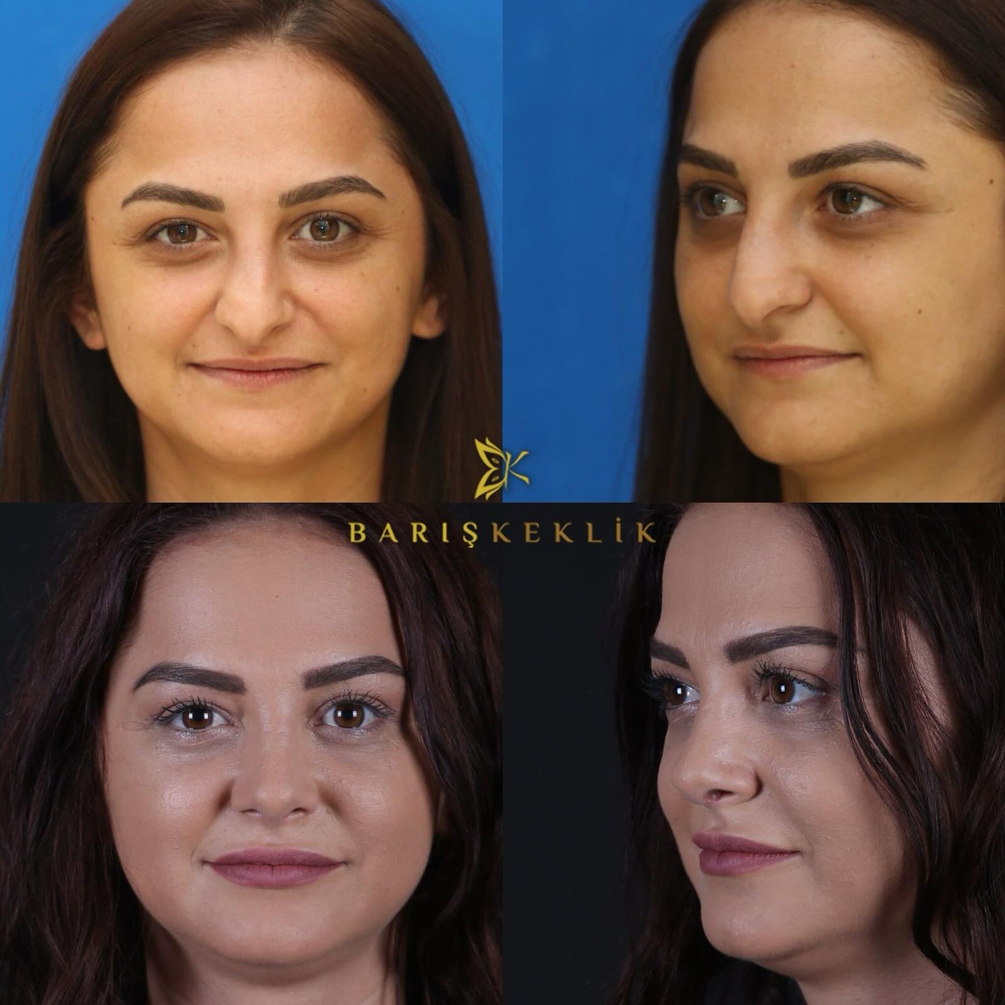 before-after