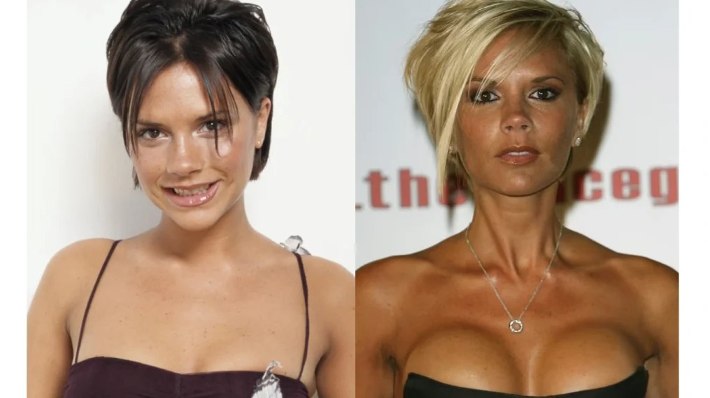 victoria beckham estetik
