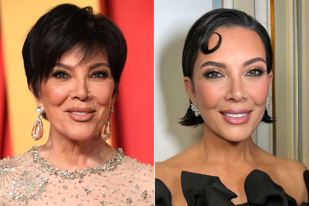 Kris Jenner Before & After